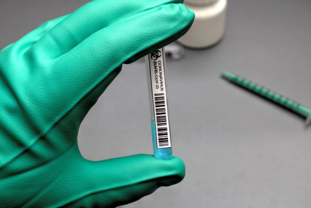 Em apenas 24 horas, Nova Friburgo registra mais 115 casos de Covid-19