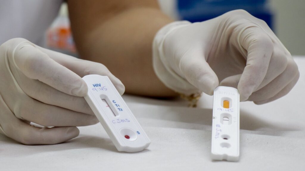Testes rápidos de HIV e sífilis são intensificados em Nova Friburgo