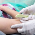implante contraceptivo hormonal