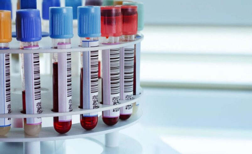 Mutirão de exames de sangue em Nova Friburgo