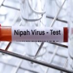 írus Nipah entra no radar global e especialistas explicam riscos