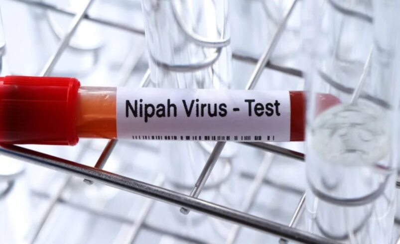 írus Nipah entra no radar global e especialistas explicam riscos