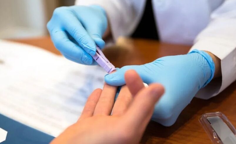 Friburgo intensifica testagem de diagnóstico Precoce do HIV
